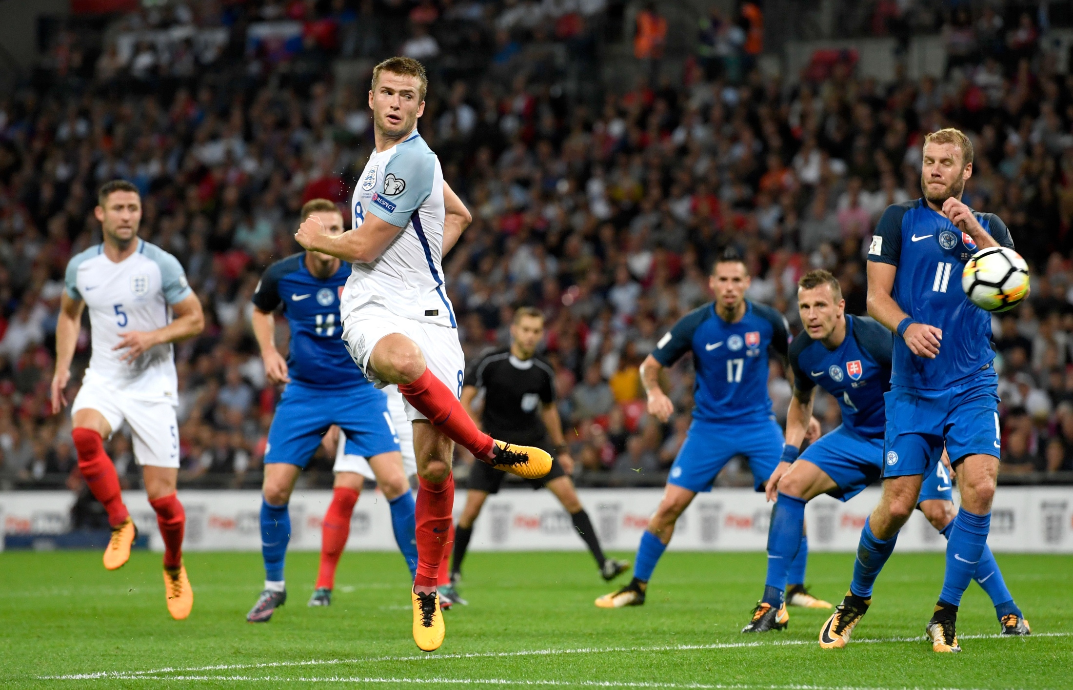 詹姆斯的痛 詹姆斯的痛